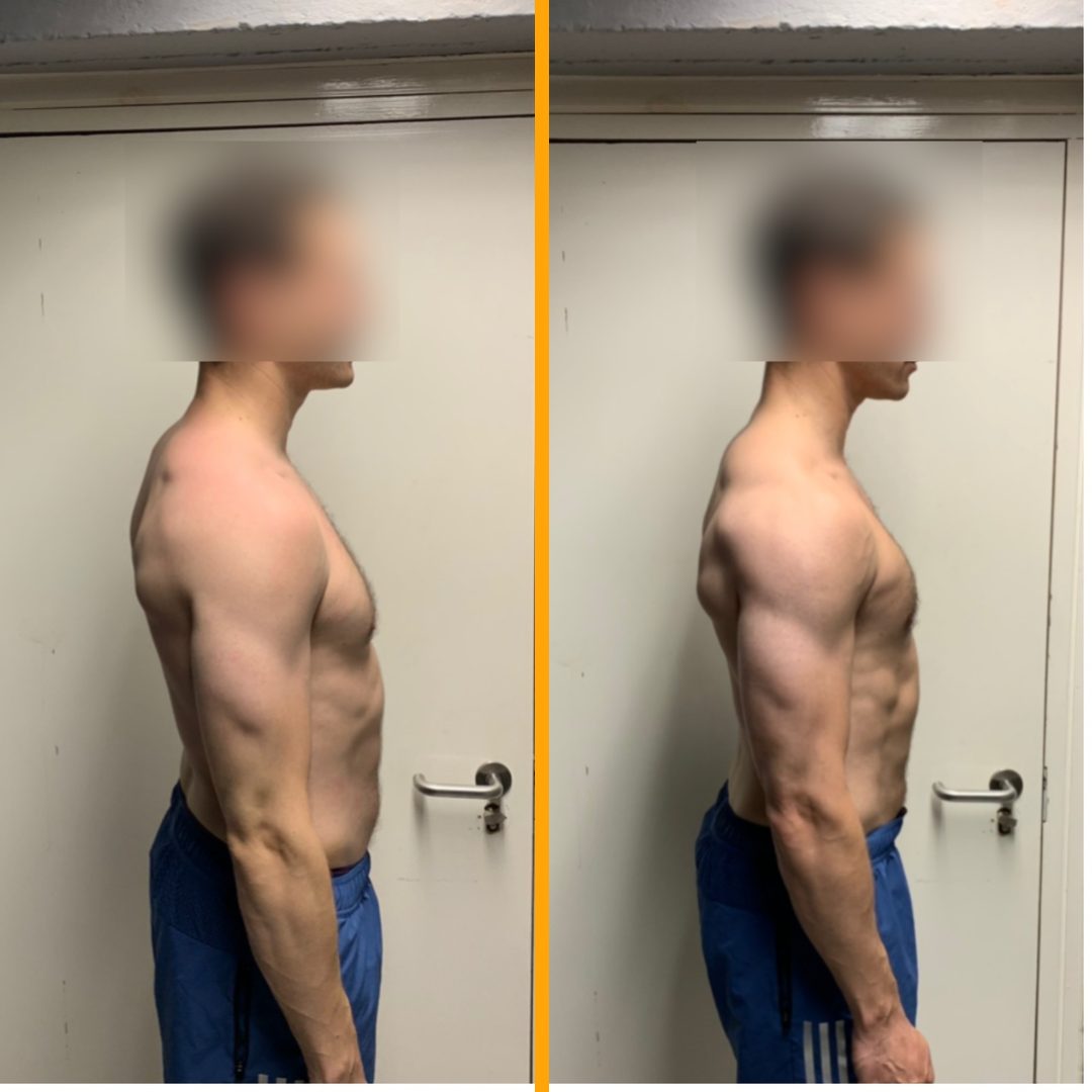 Client before and after training with Jack Maroni