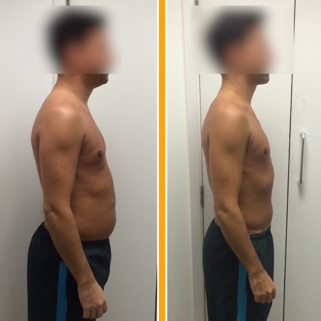 Client before and after training with Jack Maroni