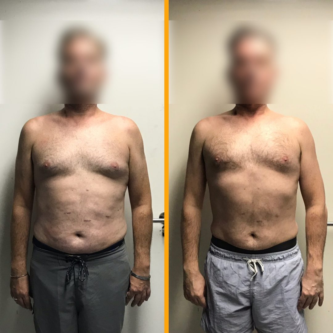 Client before and after training with Jack Maroni