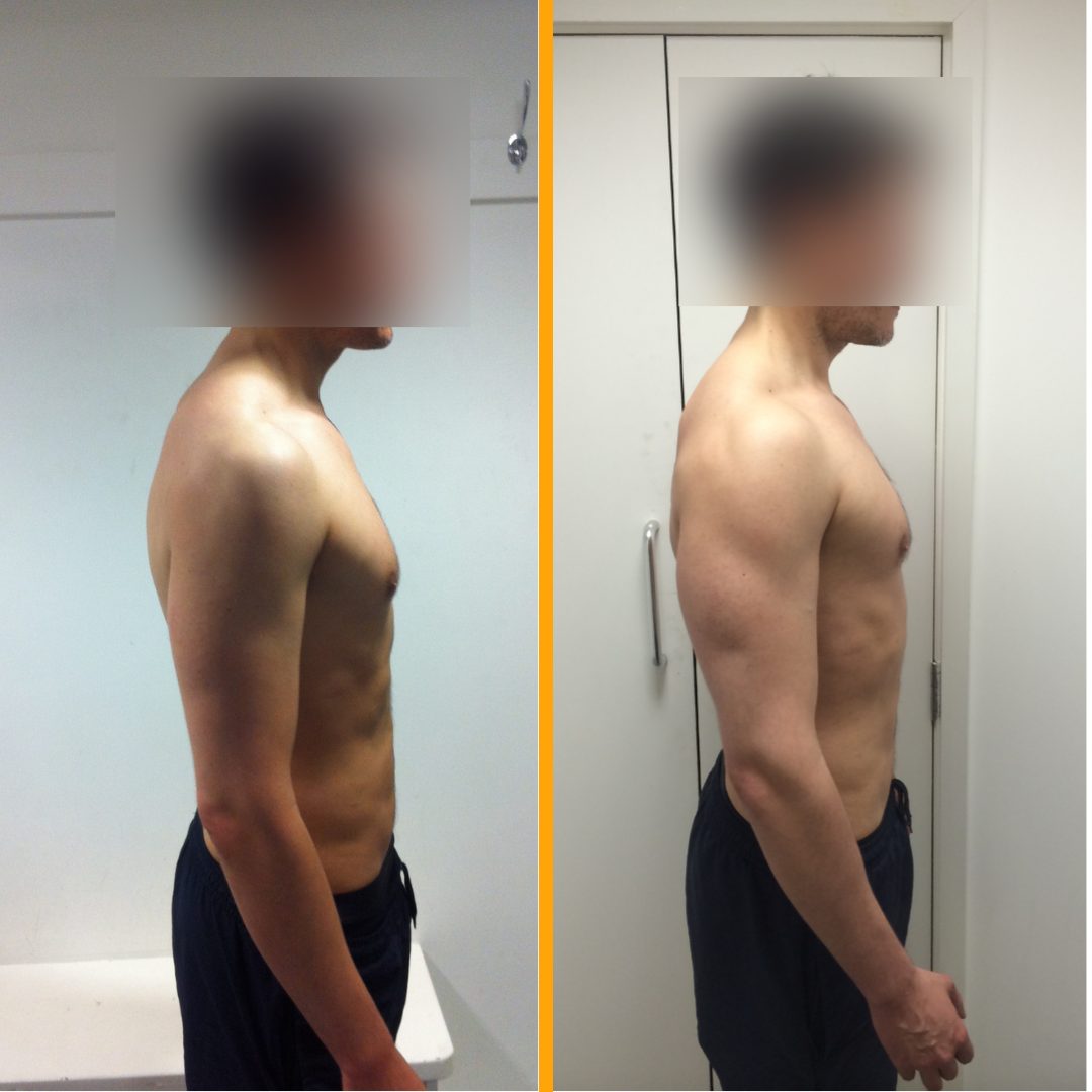 Client before and after training with Jack Maroni