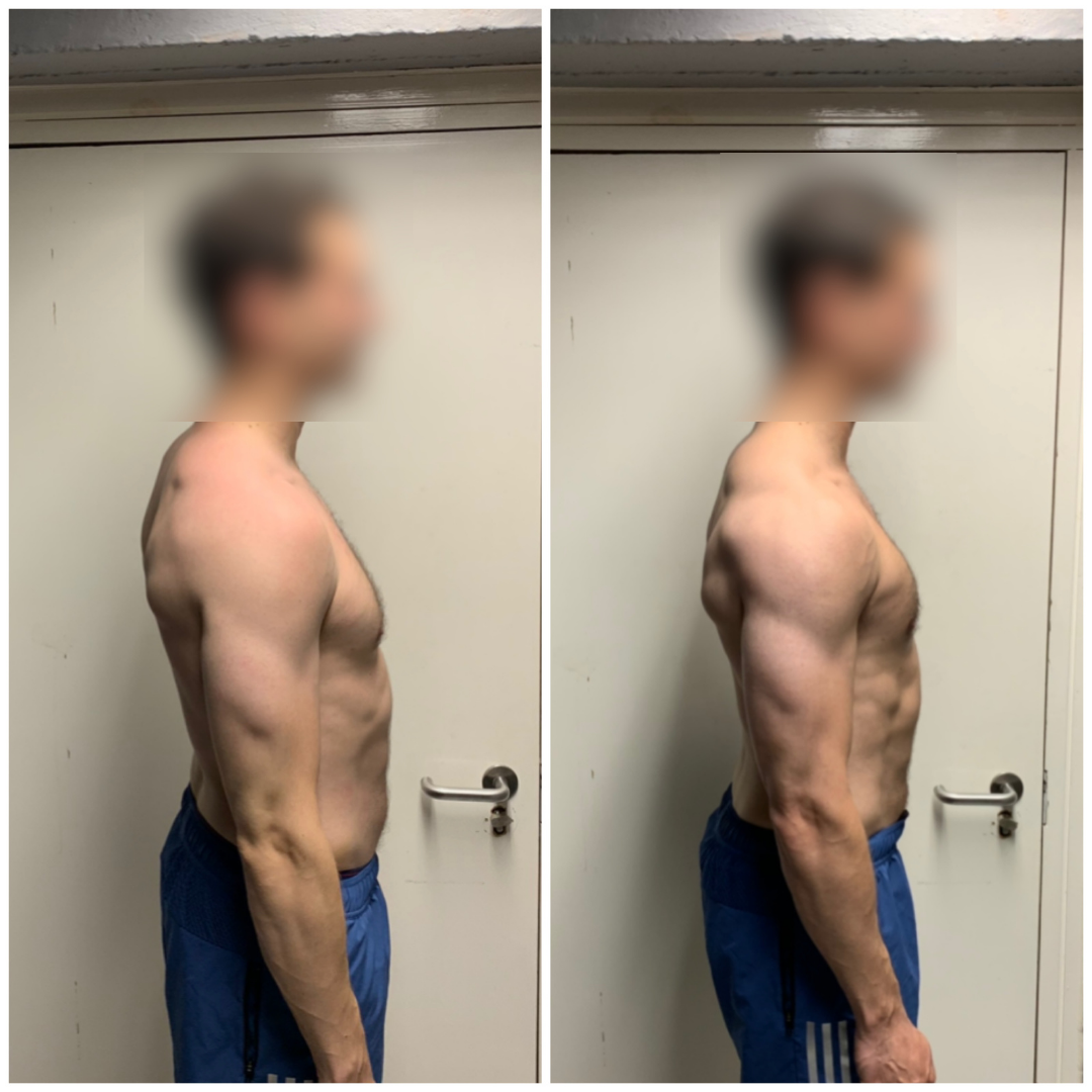 Alex before and after