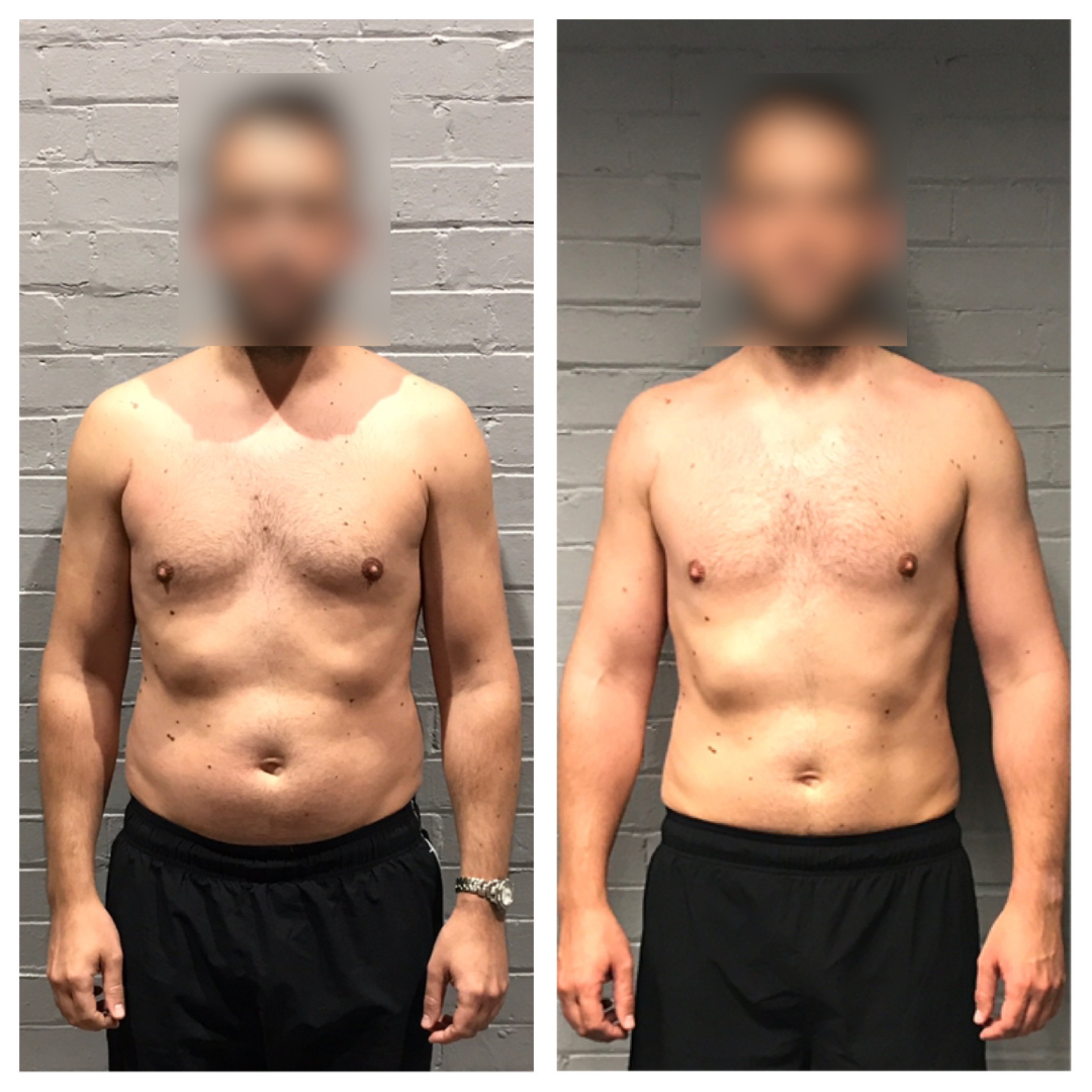 Ferg before and after